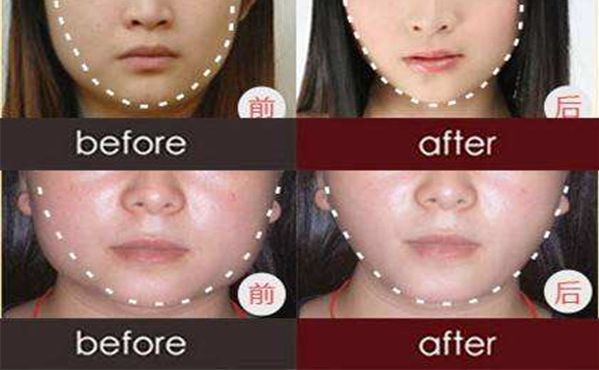 武漢市10家倍受矚目的整形診所推薦