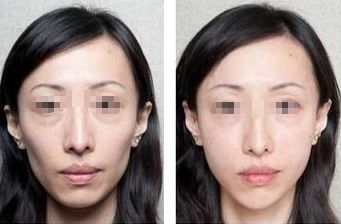 上海五家整形醫(yī)院盤點