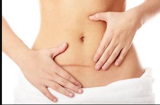 成都光子嫩膚三甲醫(yī)院綜合排名公布