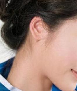 成都哪個(gè)醫(yī)院做耳朵整形效果好？