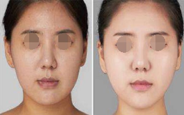 珠海博愛女子醫(yī)院整形外科項(xiàng)目全新推出，項(xiàng)目大揭秘