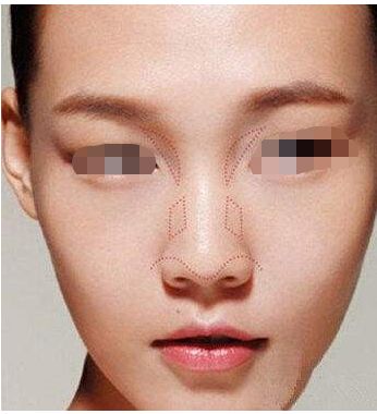 泉州哪些醫(yī)院可以信賴進行整形手術？