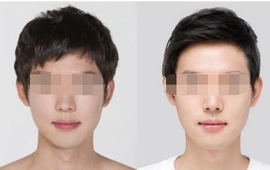 汕頭知名醫(yī)美機(jī)構(gòu)排行榜大揭秘，你知道嗎？