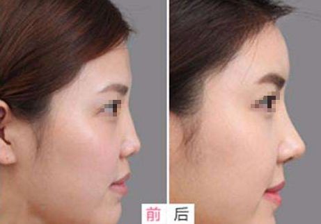 相山愛美爾醫(yī)療美容門診部，多項特色項目亮相，幫助您煥發(fā)美麗