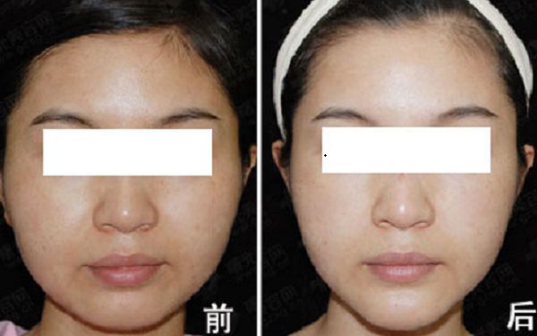 重慶市知名整形美容醫(yī)院榜單出爐！引領(lǐng)時(shí)尚潮流的醫(yī)療機(jī)構(gòu)盤點(diǎn)