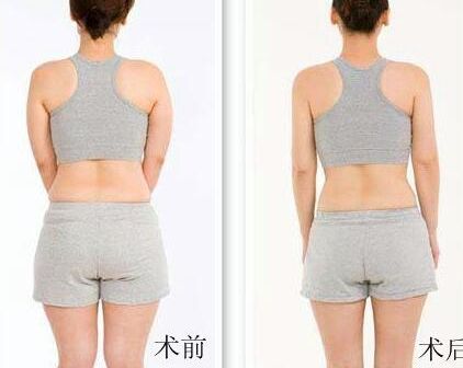 如何讓魚尾紋立即消失