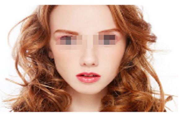 成都鼻部整形醫(yī)院排行榜前十，哪家技術最專業(yè)