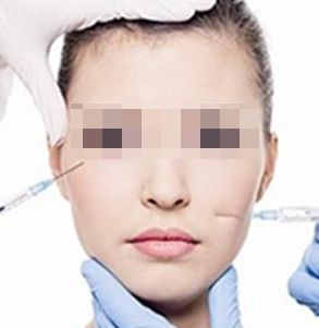 順產(chǎn)公司榜單排名，你一定要看的玻尿酸醫(yī)院選購指南！