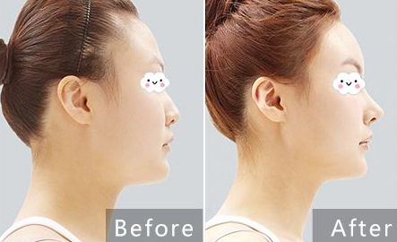 2024深圳痘斑醫(yī)院排名前10強(qiáng)