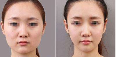 2024年北京八大處整形手術(shù)價格明細和推薦專家名錄