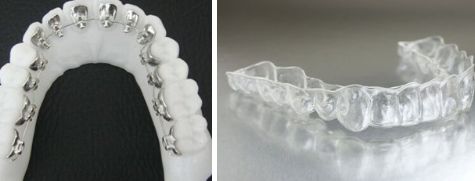 杭州有哪些紋身醫(yī)院排行榜，前三大發(fā)現(xiàn)！