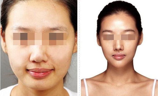 上海下巴整形哪家專業(yè)可信？