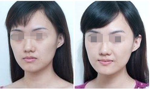 中山整形醫(yī)院八強(qiáng)名單公開！看看這些優(yōu)質(zhì)醫(yī)院是否入選受關(guān)注！