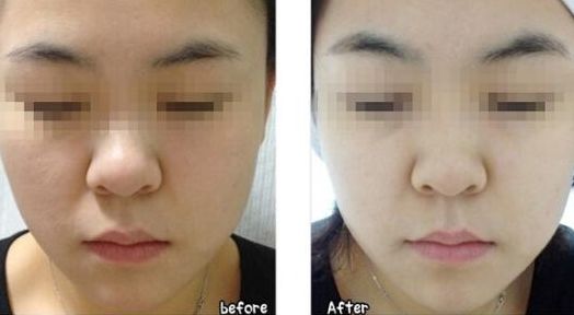 合肥哪些整形醫(yī)院名氣最大？