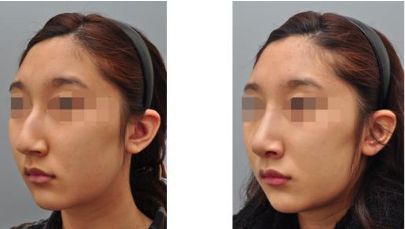 貴陽去皺比較好的醫(yī)院排行榜2024