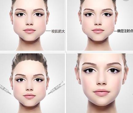 成都哪家整形美容醫(yī)院口碑好