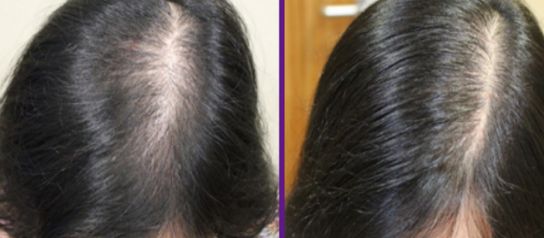 呼和浩特閆德雄醫(yī)療美容診所口碑評價及服務(wù)價格詳解