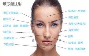 廈門(mén)熱瑪吉哪里好