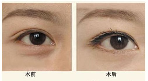 寧波市南湖區(qū)醫(yī)療美容知名醫(yī)院推薦，專家供您選擇