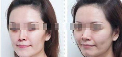 杭州整形美容醫(yī)院排名前六，你值得了解的每一家！