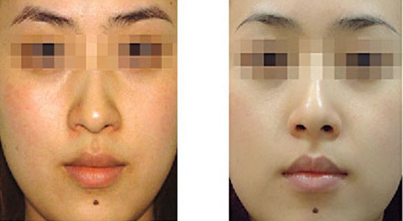 青島市城陽區(qū)吸脂整形醫(yī)院哪家好，用戶評價排名前三