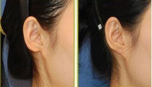 大慶拉皮手術(shù)好口碑醫(yī)院推薦：用戶(hù)真實(shí)評(píng)價(jià)分享！