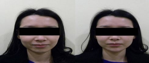 優(yōu)質(zhì)整形醫(yī)院排行榜，找哪家吸脂效果好？