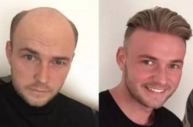 大同市第三人民醫(yī)院皮膚美容科收費(fèi)及醫(yī)生介紹