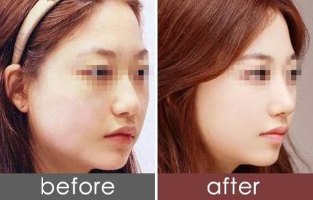 貴陽美萊黃金元美膚三周年特惠：特價套餐￥8800元！