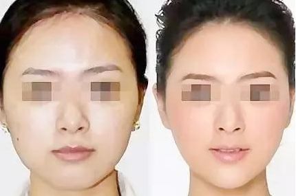 在廣東，如何選擇心儀的醫(yī)美機(jī)構(gòu)？（附醫(yī)院推薦）