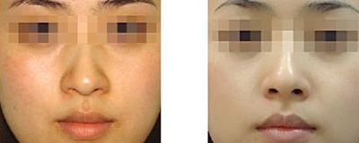 高州市人民醫(yī)院皮膚科實力分析：價格透明，醫(yī)生技術(shù)精湛