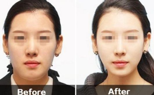 福州名韓和華美對(duì)比：口碑、項(xiàng)目一覽