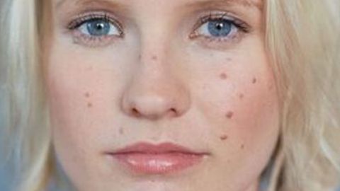 重慶中醫(yī)院整形科：專家推薦的優(yōu)秀項目及豐富醫(yī)院科室醫(yī)生信息！