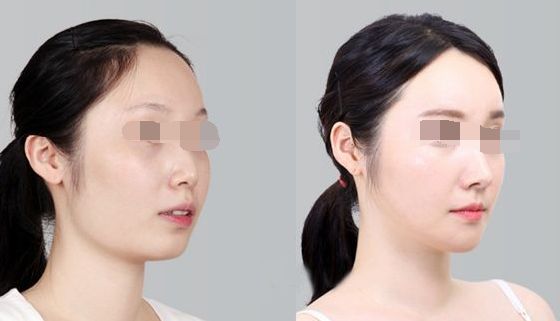 浙江整形外科醫(yī)院排行榜出爐，引領(lǐng)美麗新風(fēng)尚！