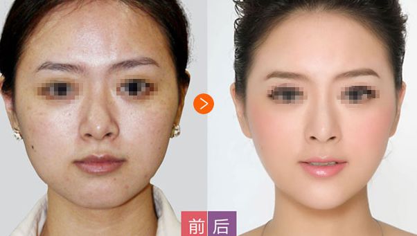 邢臺博愛高健整容致命嗎？高健整容水平值得信賴！