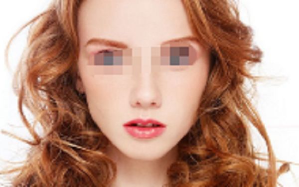 衢州哪家醫(yī)院割雙眼皮效果好？