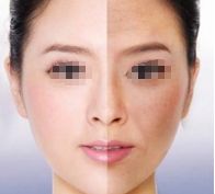 成都做韓式雙眼皮手術(shù)哪家醫(yī)院效果最好