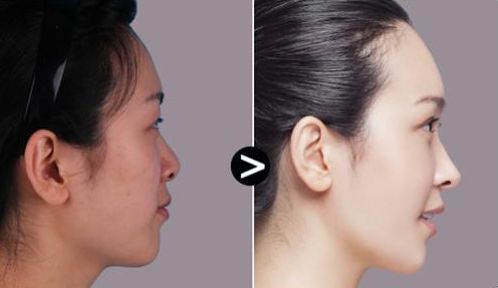 西安哪家整形醫(yī)院匯總排名前十？專業(yè)權(quán)威醫(yī)院推薦！