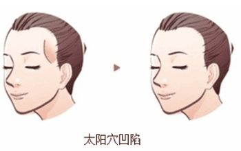 成都整形醫(yī)院排名前十名單整理，銅雀臺(tái)、米蘭柏羽何居首？