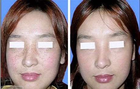 寧夏醫(yī)科大學總院燒傷美容整形科探秘：技術優(yōu)勢與費用參考