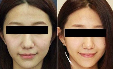 臨沂市哪家整形美容醫(yī)院口碑比較好？