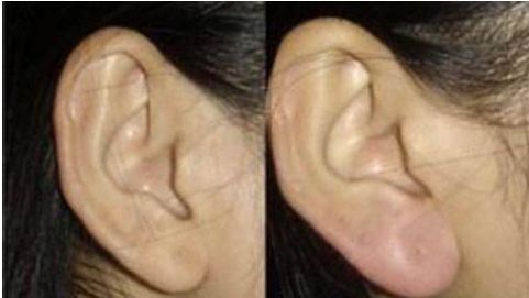 河南耳朵再造醫(yī)院排名榜單：鄭州南陽(yáng)最佳耳部整形醫(yī)院盤(pán)點(diǎn)