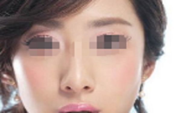 蘇州祛斑整形醫(yī)院哪家好？點擊查看排名前四家醫(yī)院名單！