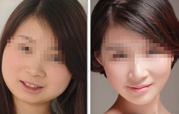 2024合肥比較好的牙齒矯正醫(yī)院前三家名單揭秘