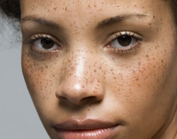 北京雙眼皮手術(shù)哪家醫(yī)院好？專業(yè)推薦前三名