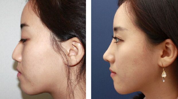 廈門整形醫(yī)院綜合排行榜單 top10，好評如潮！