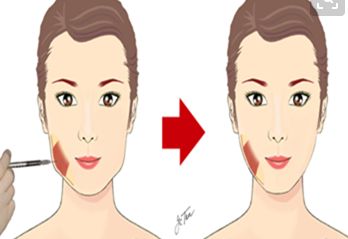 阜陽(yáng)值得信賴(lài)的眼科醫(yī)院推薦與近視手術(shù)費(fèi)用參考