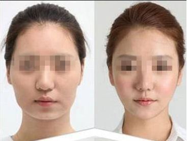 廈門市整形外科醫(yī)院綜合排名報道