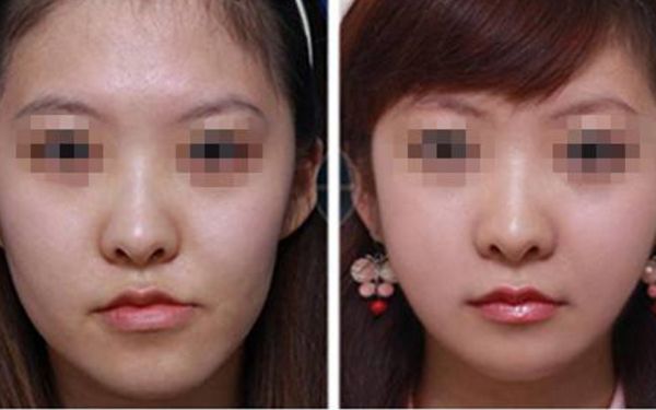 【2024】西安微整形醫(yī)院哪家好？排行榜大揭秘！