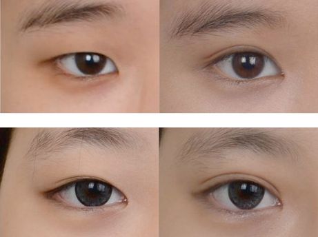 廣州瘢痕毛囊種植醫(yī)院排行榜，完美壹加壹整形醫(yī)院強勢進前十